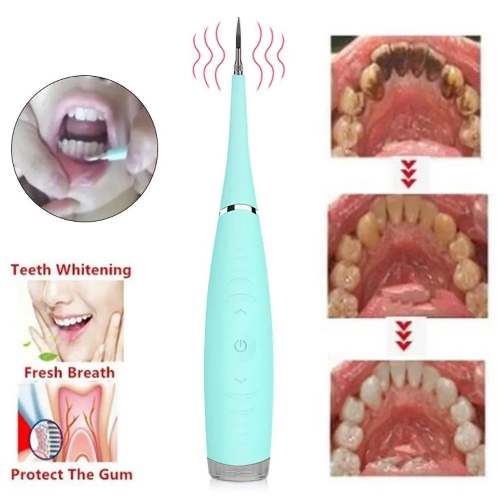 Ultimate Electric Tooth Cleaner for Deep Dental Care-1